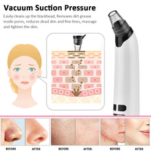 Load image into Gallery viewer, Blackhead Remover Tool
