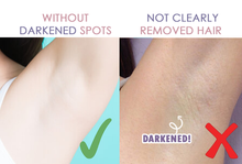 Load image into Gallery viewer, Perfect Hair Remover
